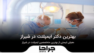 بهترین دکتر ایمپلنت در شیراز
