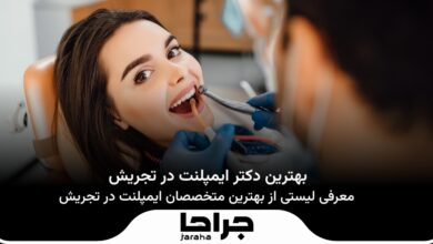 بهترین دکتر ایمپلنت در تجریش