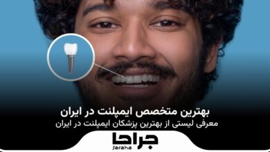 بهترین متخصص ایمپلنت در ایران