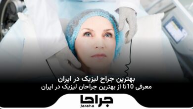 بهترین جراح لیزیک در ایران