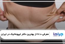بهترین دکتر لیپوماتیک در ایران