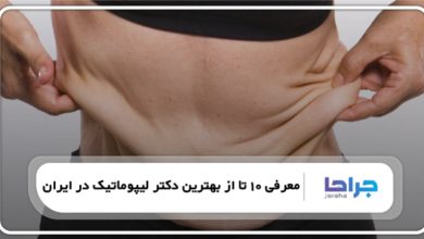 بهترین دکتر لیپوماتیک در ایران