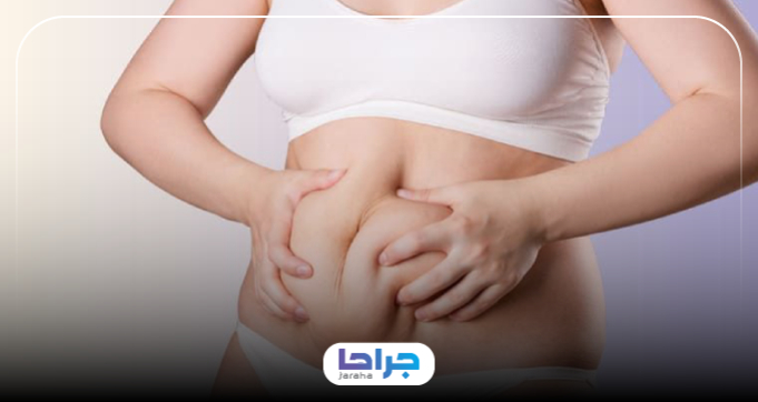 چگونه بهترین دکتر لیپوماتیک در ایران را انتخاب کنیم؟