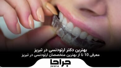 بهترین دکتر ارتودنسی در تبریز