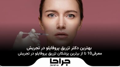 بهترین دکتر تزریق پروفایلو در تجریش