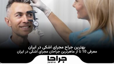 بهترین جراح مجرای اشکی در ایران