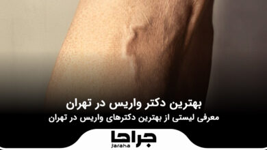 بهترین دکتر واریس در تهران