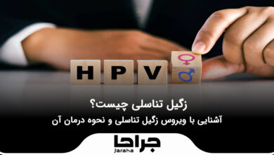 زگیل تناسلی چیست؟