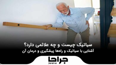 سیاتیک چیست و چه علائمی دارد؟