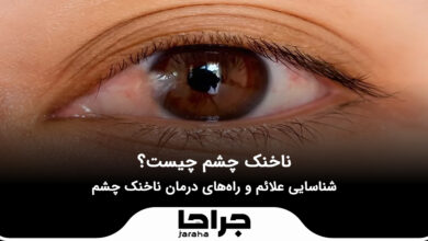 ناخنک چشم چیست؟ علائم و راههای درمان آن که باید بدانید!
