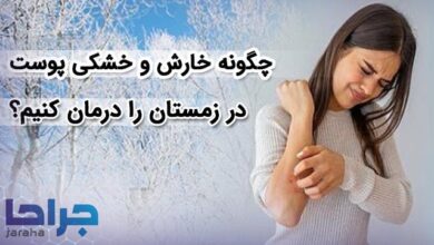 چگونه خارش و خشکی پوست در زمستان را درمان کنیم؟