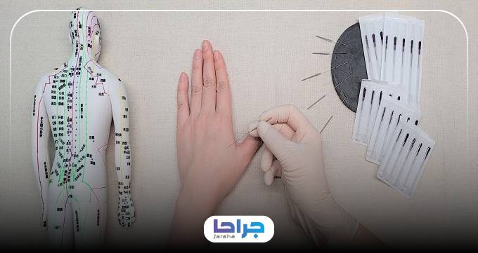 توصیههای بهترین دکتر طب سوزنی در ایران به مراجعین