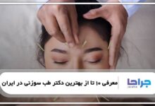 بهترین دکتر طب سوزنی در ایران