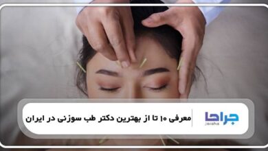 بهترین دکتر طب سوزنی در ایران