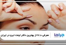 بهترین دکتر لیفت ابرو در ایران