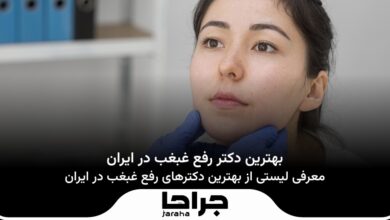 بهترین دکتر رفع غبغب در ایران