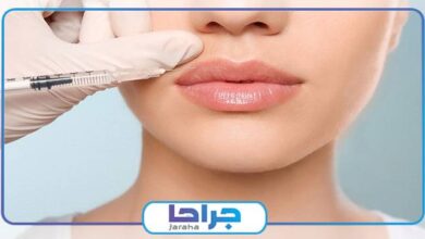 What points should be observed after lip gel?