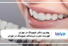 بهترین دکتر بلیچینگ در تهران