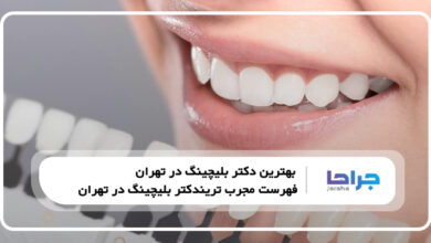 بهترین دکتر بلیچینگ در تهران