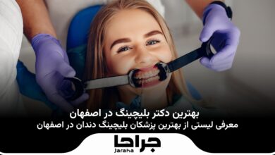 بهترین دکتر بلیچینگ در اصفهان