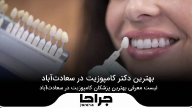 بهترین دکتر کامپوزیت در سعادت آباد