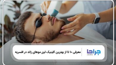10 تا از بهترین کلینیک لیزر موهای زائد در افسریه