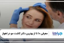 بهترین دکتر کاشت مو در اهواز