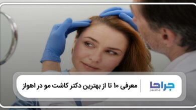 بهترین دکتر کاشت مو در اهواز