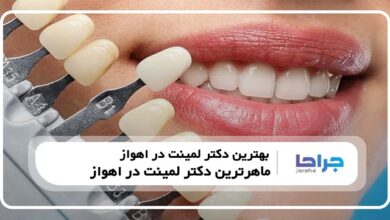 بهترین دکتر لمینت در اهواز