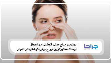 بهترین جراح بینی گوشتی در اهواز