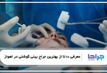 بهترین جراح بینی گوشتی در اهواز