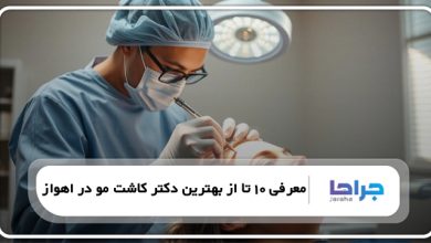 بهترین دکتر کاشت مو در اهواز