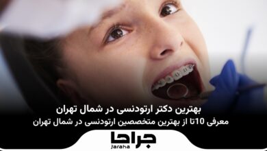 بهترین دکتر ارتودنسی در شمال تهران