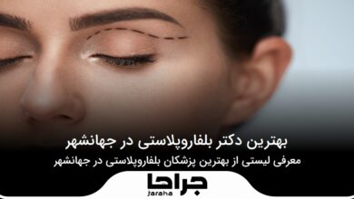 بهترین دکتر بلفاروپلاستی در جهانشهر