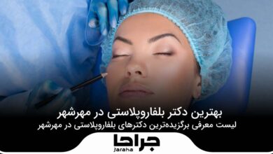 5 تا از بهترین دکتر بلفاروپلاستی در مهرشهر