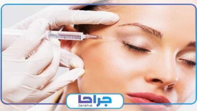 بهترین دکتر بوتاکس در مهرویلا