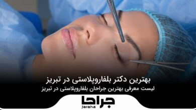 بهترین دکتر بلفاروپلاستی در تبریز