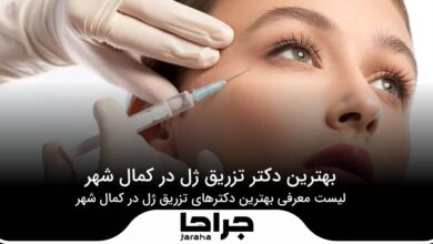 5 تا از بهترین دکتر تزریق ژل در کمال شهر