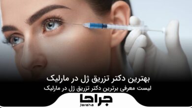 بهترین دکتر تزریق ژل در مارلیک