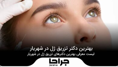 5 تا از بهترین دکتر تزریق ژل در شهریار