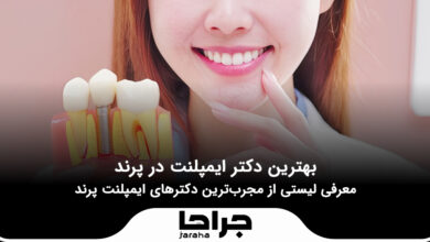 بهترین دکتر ایمپلنت در پرند