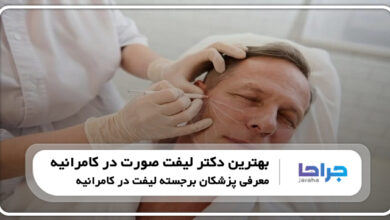بهترین دکتر لیفت صورت در کامرانیه