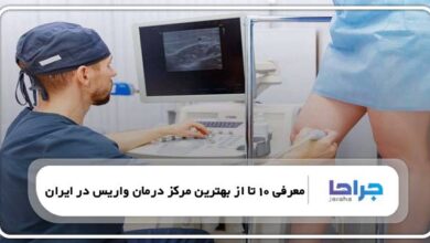 بهترین مرکز درمان واریس در ایران