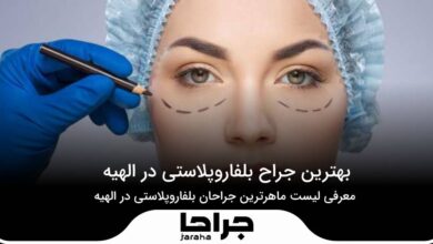 5 تا از بهترین جراح بلفاروپلاستی در الهیه