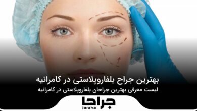 5 تا از بهترین جراح بلفاروپلاستی در کامرانیه
