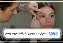 10 تا از بهترین دکتر کاشت ابرو در ولیعصر