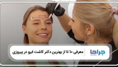 بهترین دکتر کاشت ابرو در پیروزی