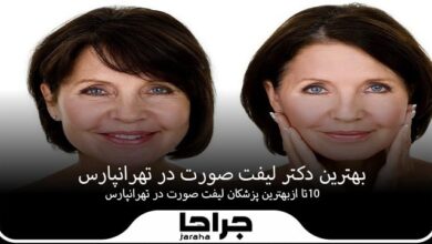 بهترین دکتر لیفت صورت در تهرانپارس