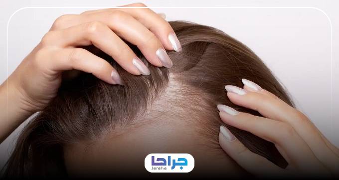 نکات کلیدی در انتخاب بهترین دکتر ریزش مو در کرج از نظر وبسایت جراحا