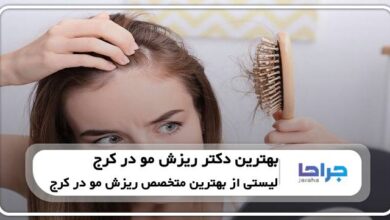 بهترین دکترهای ریزش مو در کرج